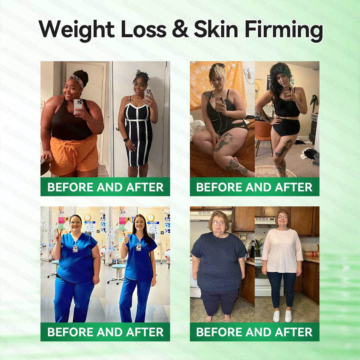 𝐆𝐋𝐎𝑹𝑬𝑵𝑫𝗔®𝑴𝒐𝒓𝒊𝒏𝒈𝗮 · 𝗕𝗲𝗿𝗯𝗲𝗿𝙞𝙣𝙚 × 𝙉𝘼𝐃+ 𝟏𝟎-𝐢𝐧-𝟏 𝗔𝗱𝘃𝗮𝗻𝗰𝙚𝙙 𝙉𝙖𝙣𝙤 𝙈𝙞𝙘𝙧𝙤𝙣𝙚𝙚𝐝𝐥𝐞 𝐏𝐚𝐭𝙘𝙝(𝐉𝐮𝐬𝐭 𝐨𝐧𝐜𝐞 𝐚 𝐝𝐚𝐲, 𝐯𝐢𝐬𝐢𝐛𝐥𝐞 𝐜𝐡𝐚𝐧𝐠𝐞𝐬 𝐢𝐧 𝟕 𝐝𝐚𝐲𝐬）🔥𝐅𝐨𝐫 𝐨𝐛𝐞𝐬𝐢𝐭𝐲, 𝐋𝐎𝐎𝐒𝐄 𝐒𝐊𝐈𝐍 ,𝐝𝐢𝐚𝐛𝐞𝐭𝐞𝐬, 𝐬𝐥𝐞𝐞𝐩 𝐚𝐩𝐧𝐞𝐚, 𝐣𝐨𝐢𝐧𝐭 𝐢𝐬𝐬𝐮𝐞𝐬, 𝐚𝐧𝐝 𝐦𝐨𝐫𝐞🔥