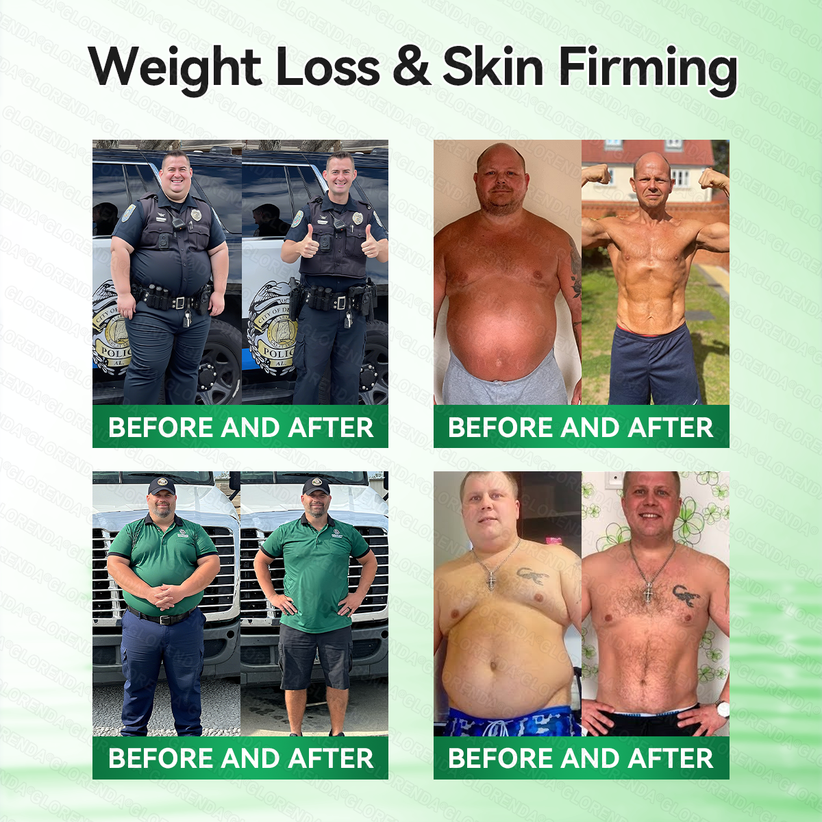 𝐆𝐋𝐎𝑹𝑬𝑵𝑫𝗔®𝑴𝒐𝒓𝒊𝒏𝒈𝗮 · 𝗕𝗲𝗿𝗯𝗲𝗿𝙞𝙣𝙚 × 𝙉𝘼𝐃+ 𝟏𝟎-𝐢𝐧-𝟏 𝗔𝗱𝘃𝗮𝗻𝗰𝙚𝙙 𝙉𝙖𝙣𝙤 𝙈𝙞𝙘𝙧𝙤𝙣𝙚𝙚𝐝𝐥𝐞 𝐏𝐚𝐭𝙘𝙝(𝐉𝐮𝐬𝐭 𝐨𝐧𝐜𝐞 𝐚 𝐝𝐚𝐲, 𝐯𝐢𝐬𝐢𝐛𝐥𝐞 𝐜𝐡𝐚𝐧𝐠𝐞𝐬 𝐢𝐧 𝟕 𝐝𝐚𝐲𝐬）🔥𝐅𝐨𝐫 𝐨𝐛𝐞𝐬𝐢𝐭𝐲, 𝐋𝐎𝐎𝐒𝐄 𝐒𝐊𝐈𝐍 ,𝐝𝐢𝐚𝐛𝐞𝐭𝐞𝐬, 𝐬𝐥𝐞𝐞𝐩 𝐚𝐩𝐧𝐞𝐚, 𝐣𝐨𝐢𝐧𝐭 𝐢𝐬𝐬𝐮𝐞𝐬, 𝐚𝐧𝐝 𝐦𝐨𝐫𝐞🔥